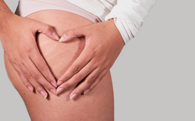 Nowe życie – no cellulit