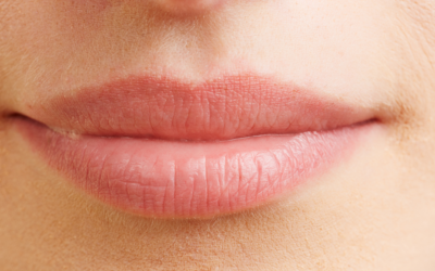 Opryszczka – czy dieta może pomóc?